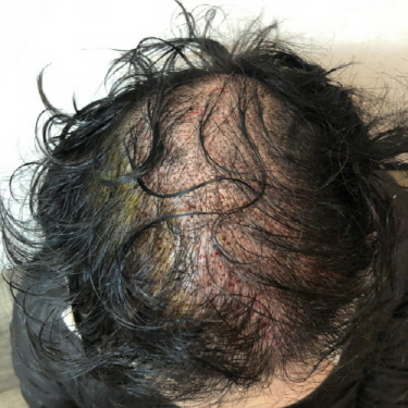 수술당일1.jpg