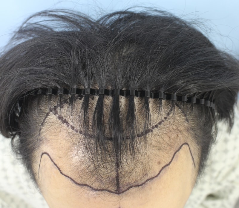 김 종연_20160429_모발_21881.png