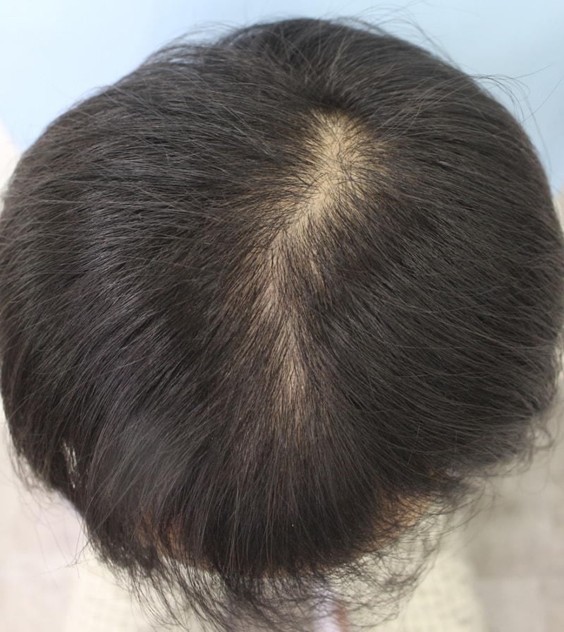김 종연_20160429_모발_21870.png