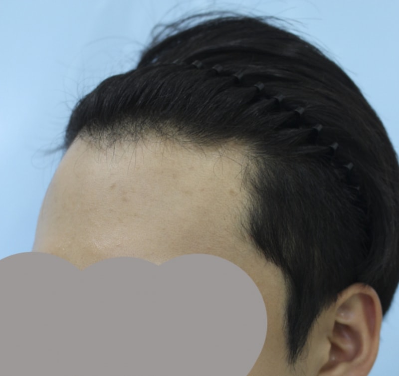 김 정헌_20160628_모발_31726.jpg