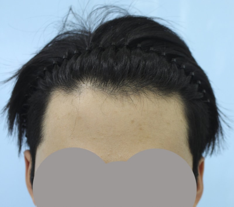 김 정헌_20160628_모발_31723.jpg