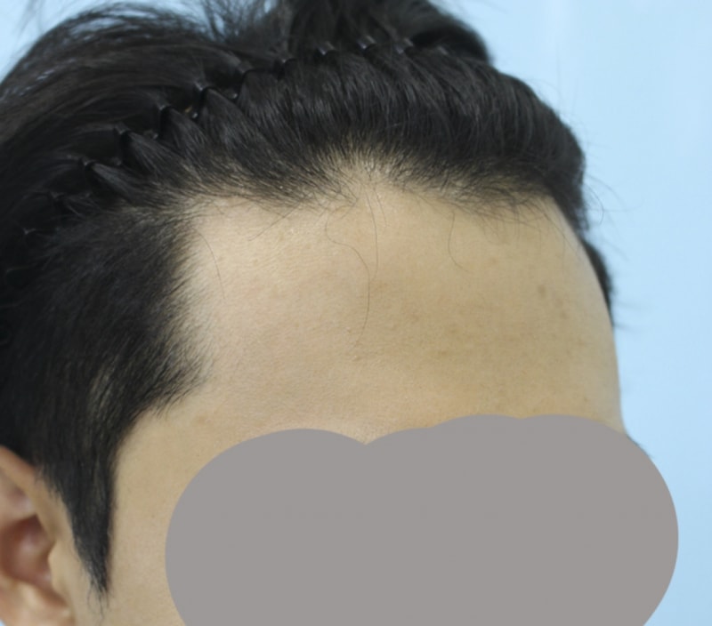 김 정헌_20160628_모발_31724.jpg