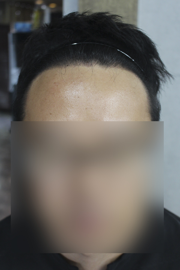 6개월 설레는 맘으로 후기 남겨요