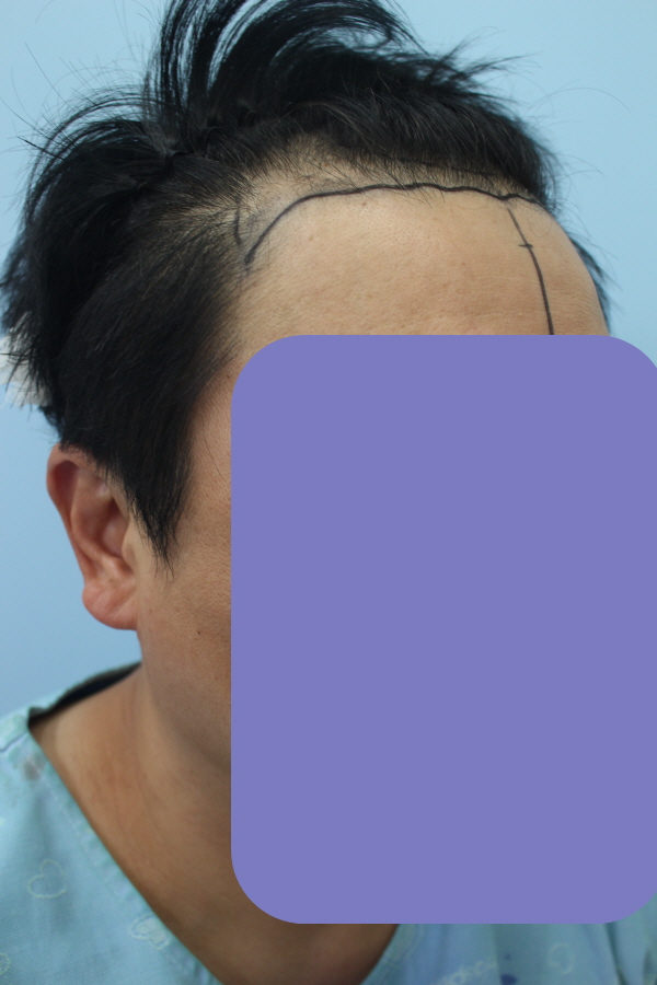 이식했지여 2.JPG