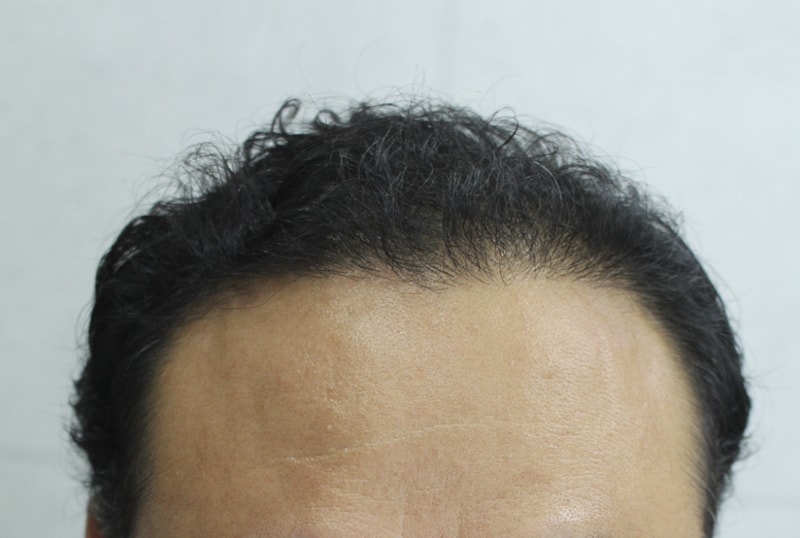 7달경과 (2).png