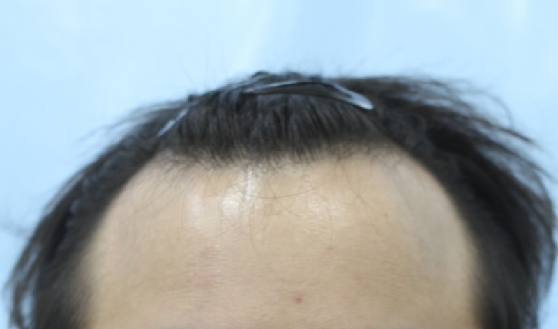 이 창희_20170710_모발_108344.png