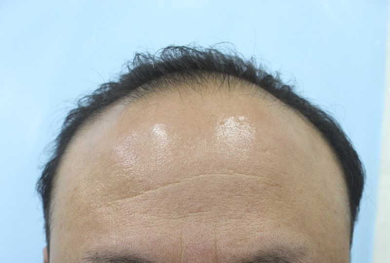 정 대덕_20131118_모발_132349.png