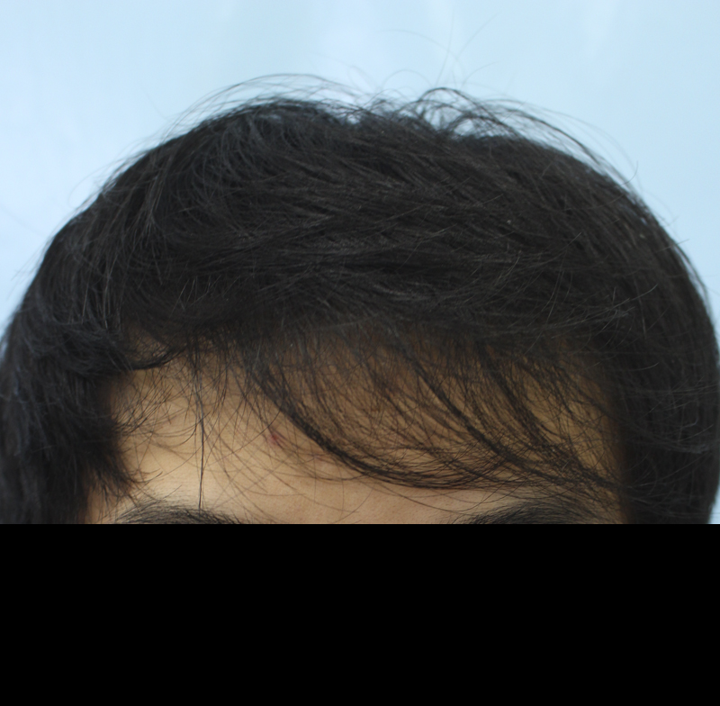 001.jpg