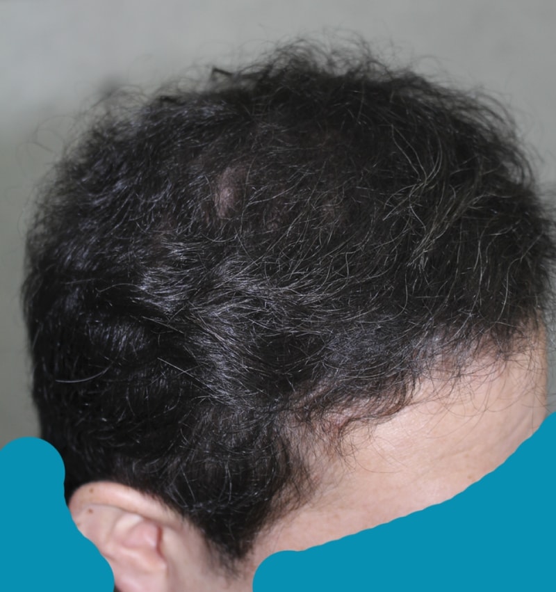 IMG_6504_6개월.png