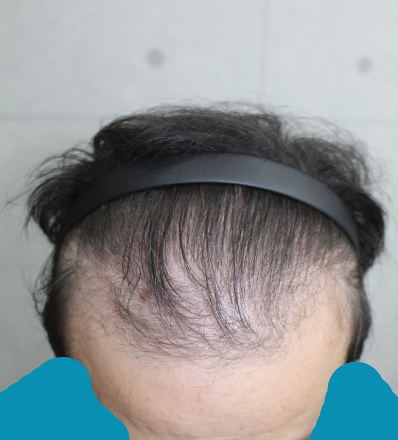 IMG_1441_전.png