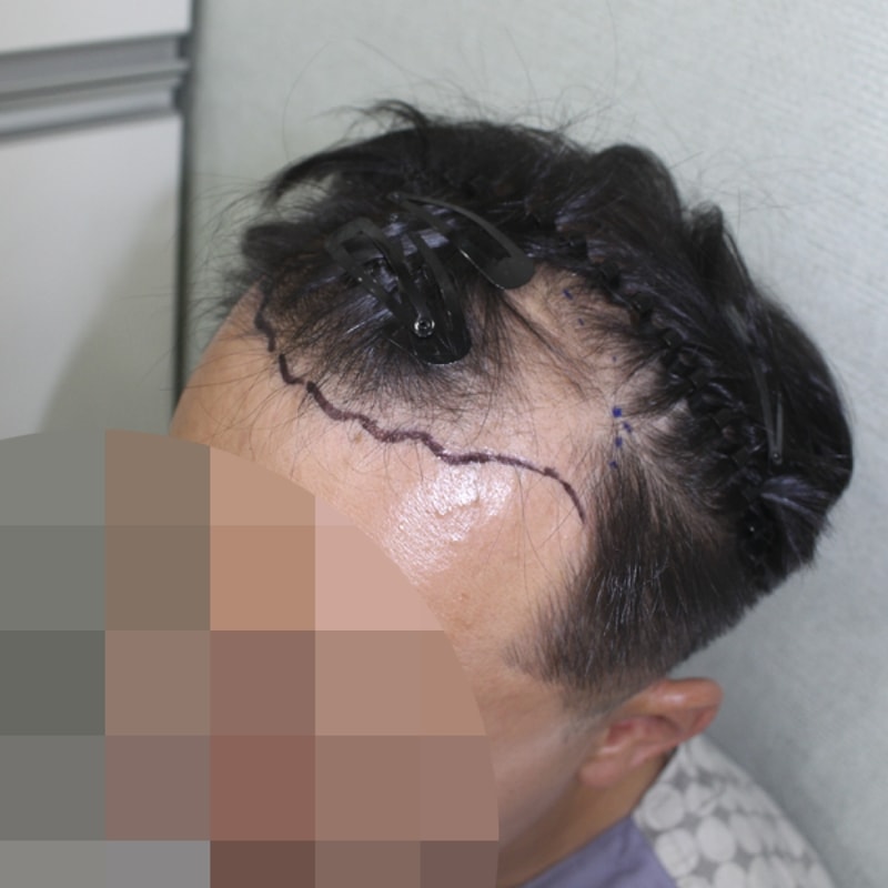 이 창석_20160808_모발_39710.png