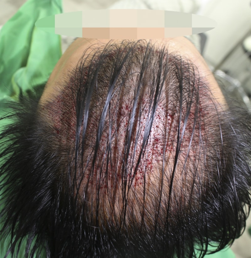 이 창석_20160808_모발_39719.png