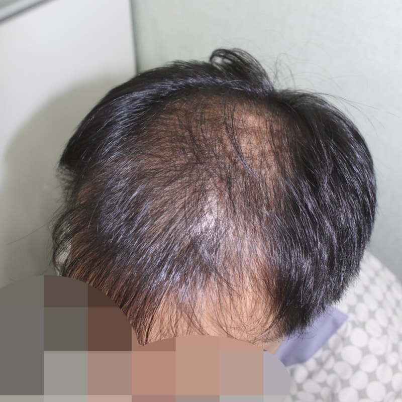 이 창석_20160808_모발_39691.png