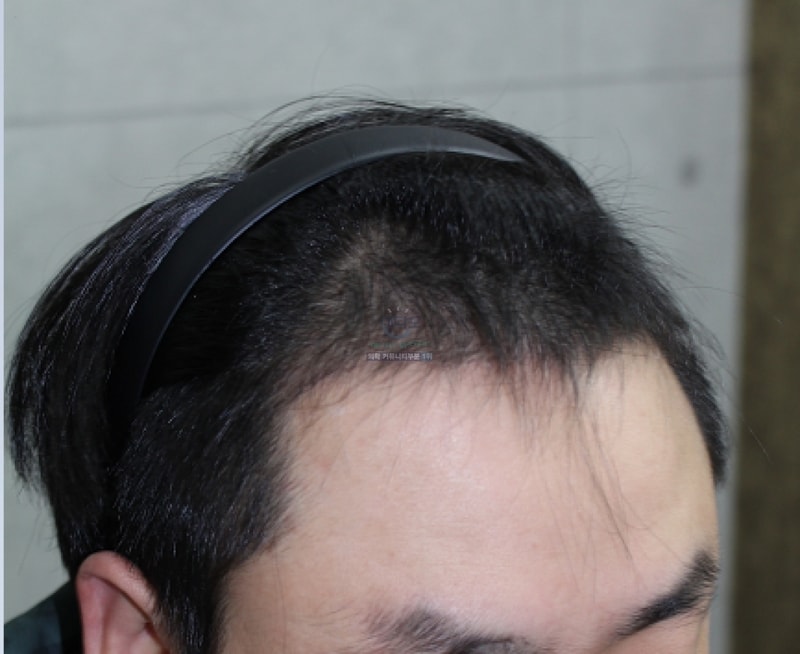 3개월 측면.PNG