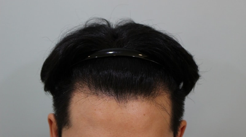 3개월 정면 수.jpg