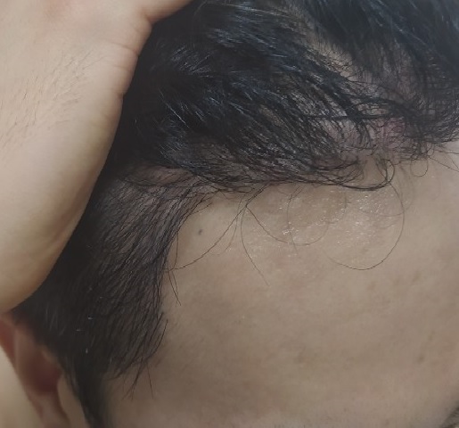 머리 오.jpg