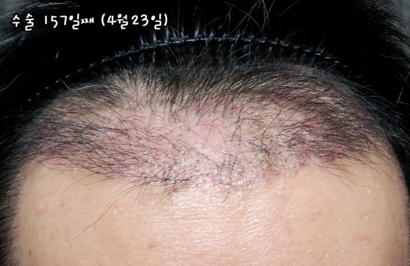 상단4-23(157일째)s.jpg