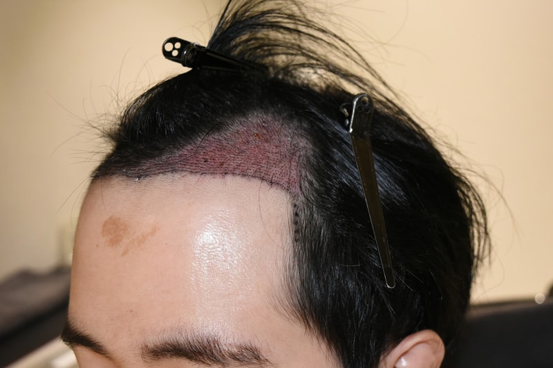 샴푸 후 측면.jpg