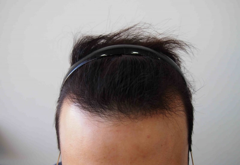 수술전 1.JPG