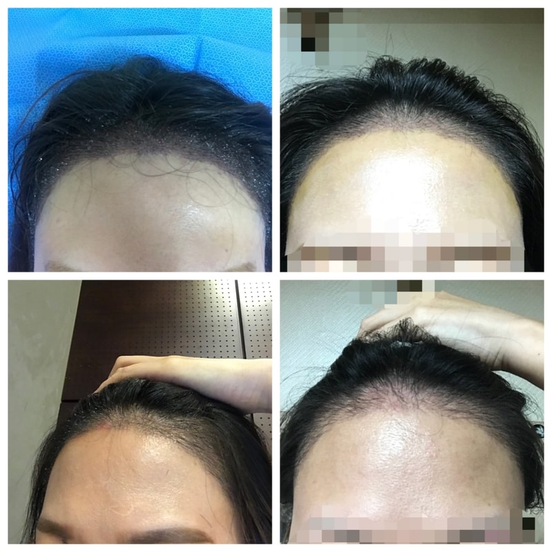 hairline.jpg