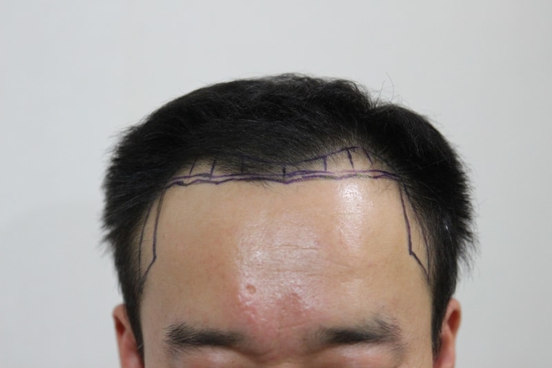 전 정면.JPG