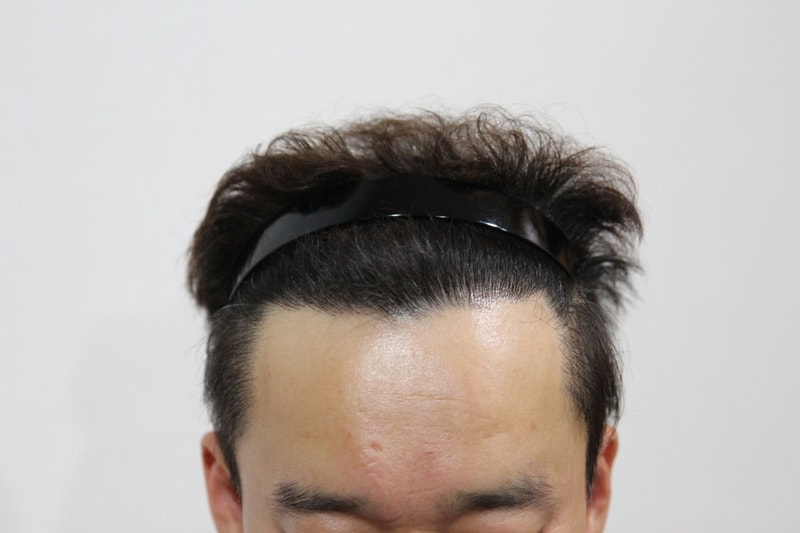 후 정면.JPG
