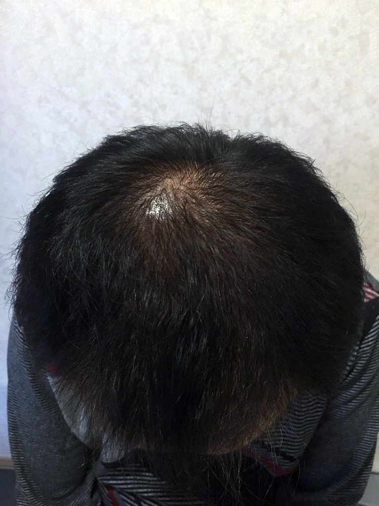 7개월.jpg
