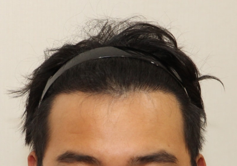 후 (1).JPG