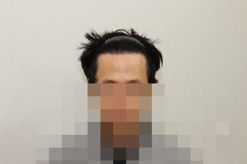 후 (1).JPG