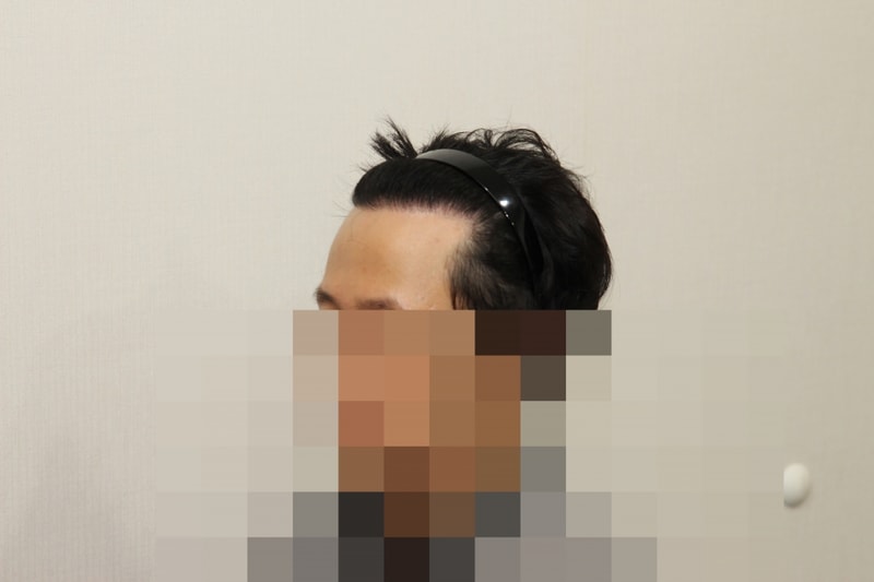 후 (2).JPG