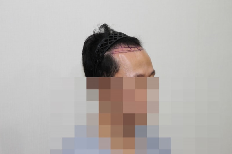 전 (3).JPG