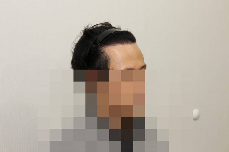 후 (3).JPG