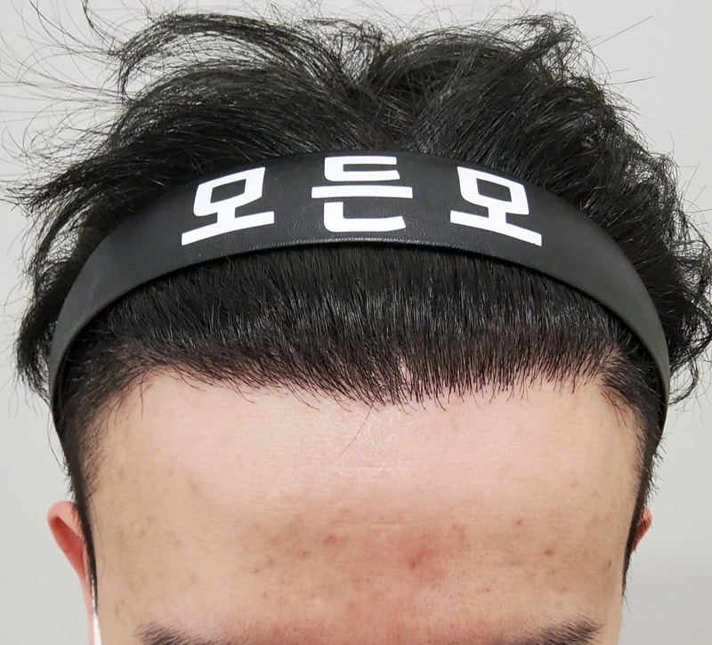 4. 수술후_1년_1.jpg