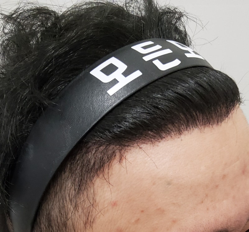 4. 수술후_1년_3.jpg