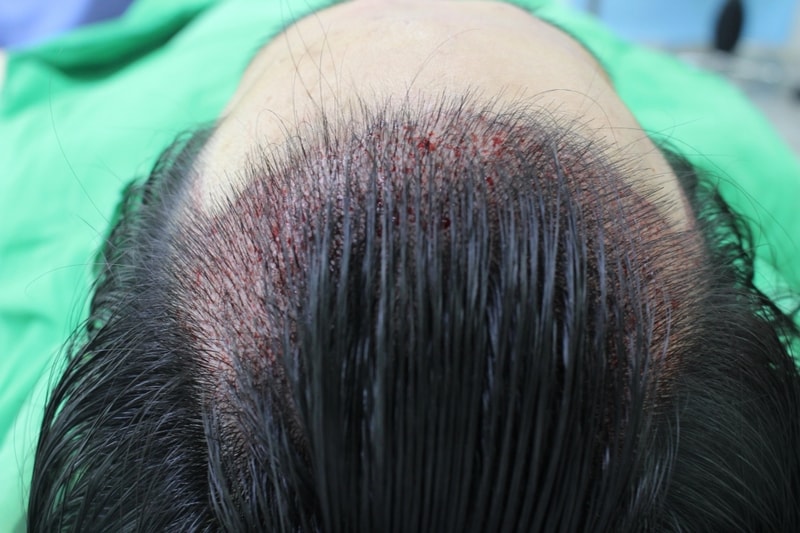 hair_03.jpg