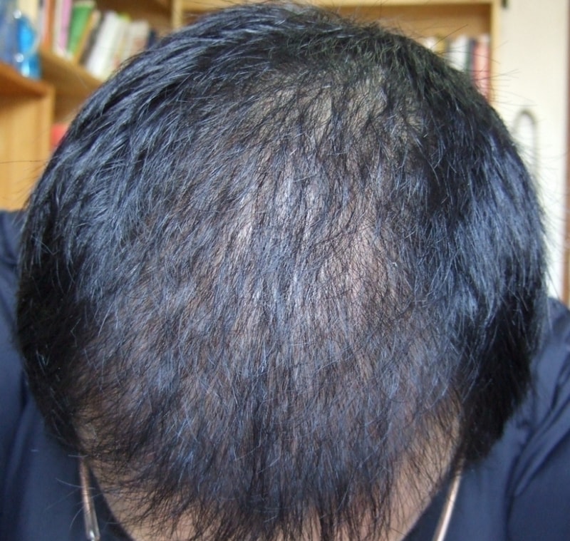 3month - no flash.JPG