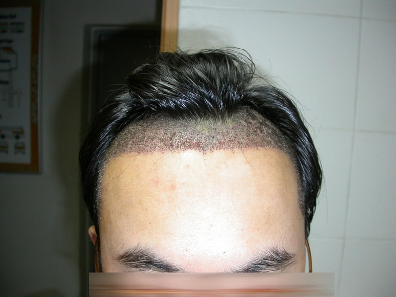 수술후1.jpg