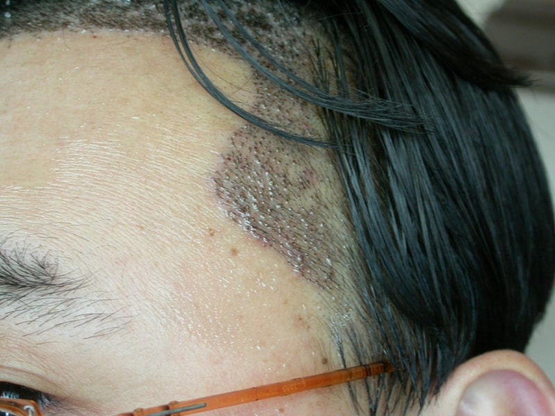 수술후5.jpg