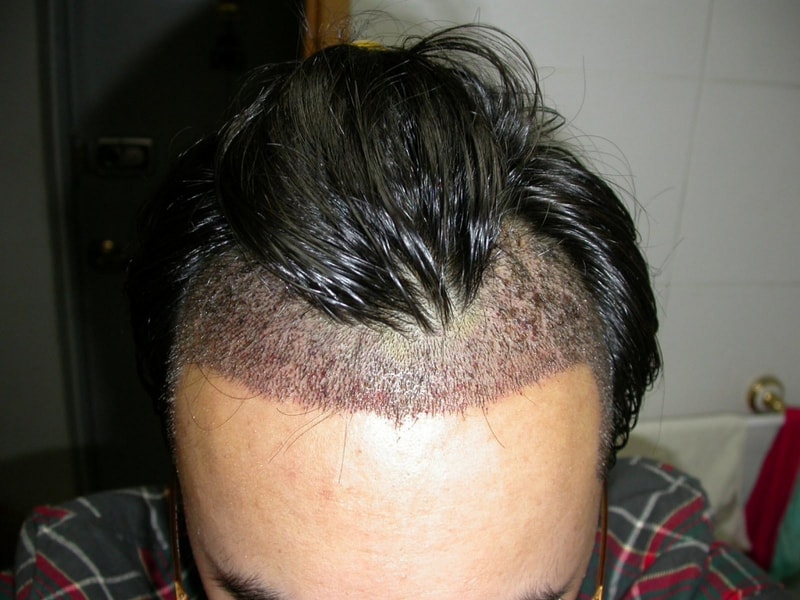 수술후2.jpg