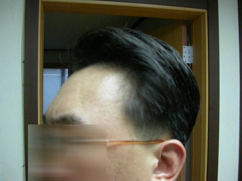 수술전3.jpg