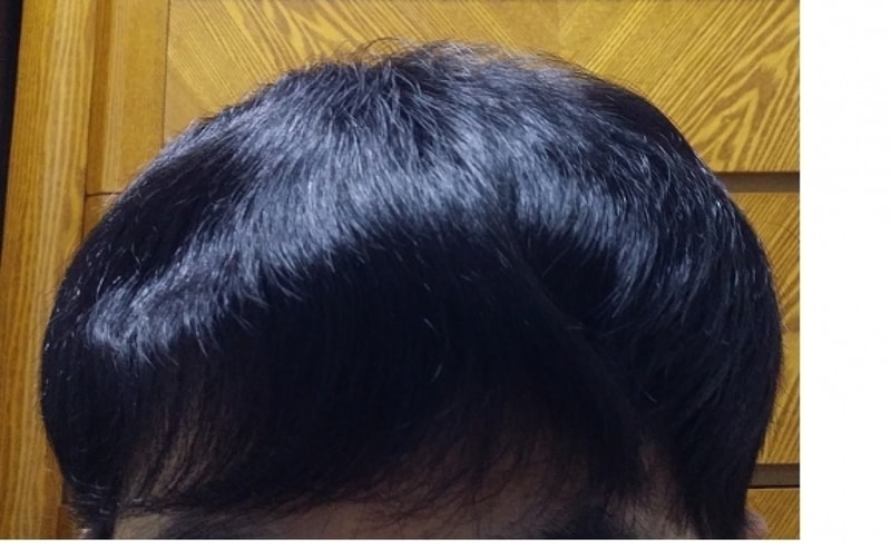 내린머리.png