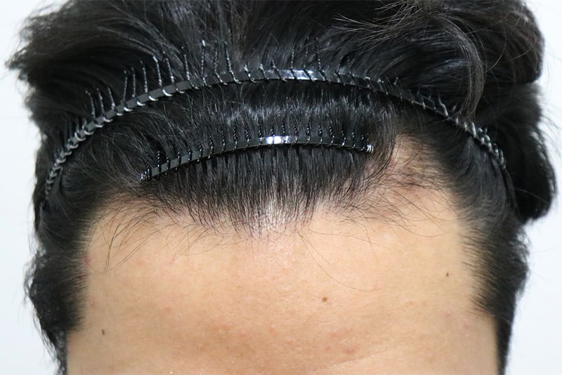 9개월차 농사 경과 알려드리려고 왔습니다!