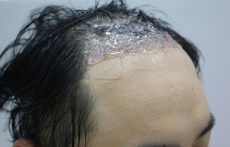 2.JPG
