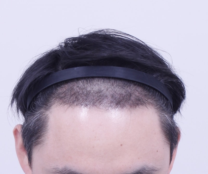 3달1.JPG