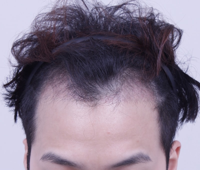1달1.JPG