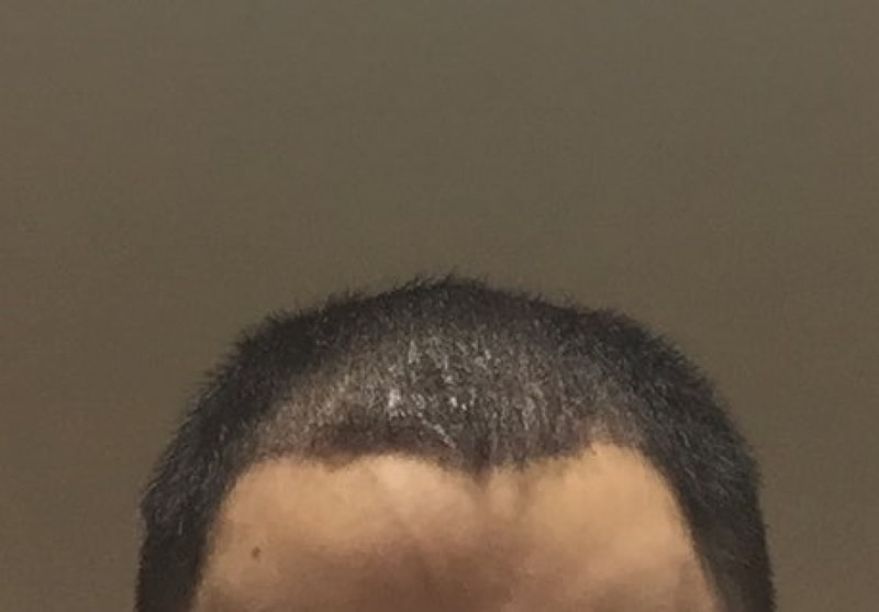 12일 차_정면1.jpg