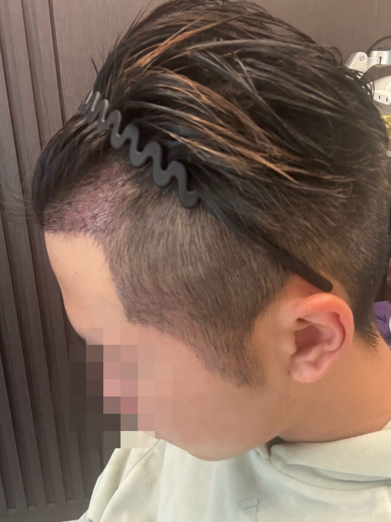 후1.jpg