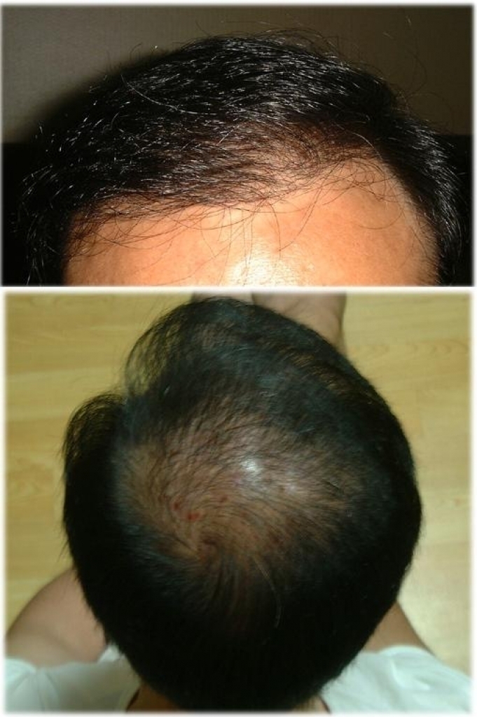 front-10month.JPG