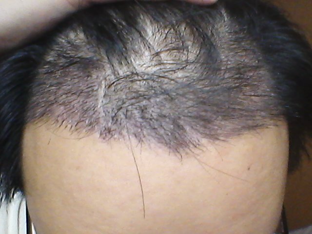 2011-12-05 21.32.19.jpg
