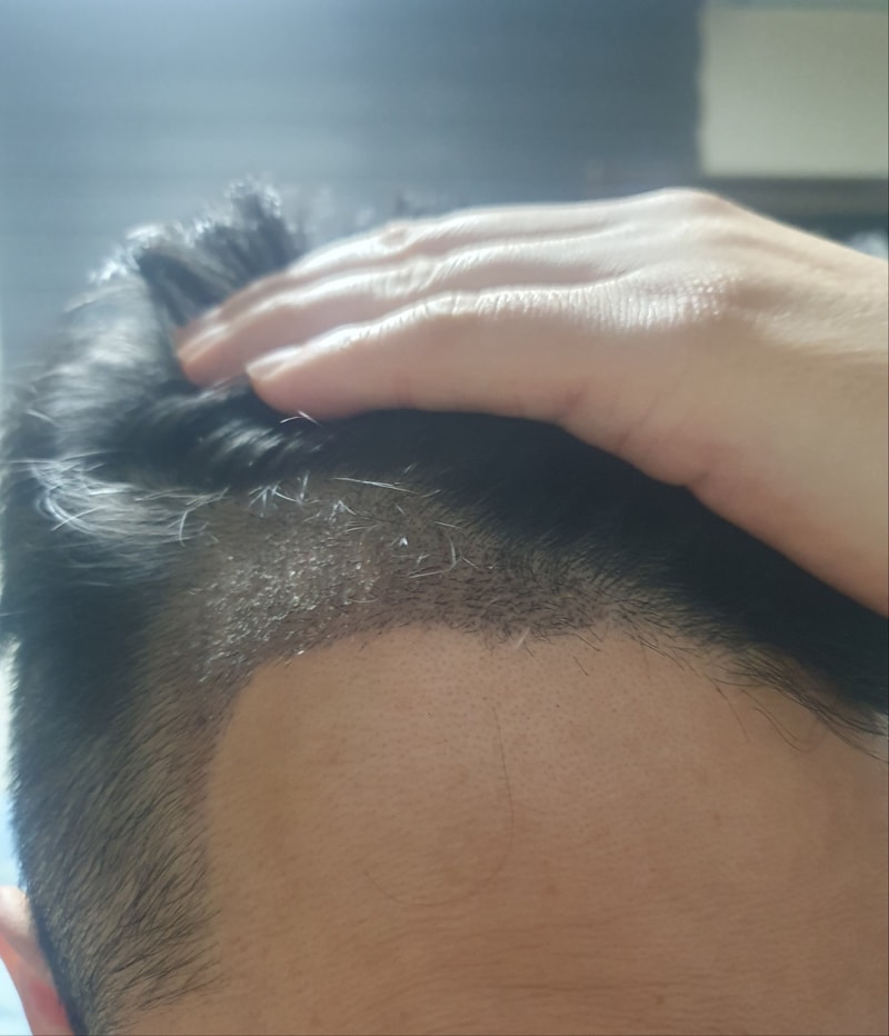 10일 경과1.jpg